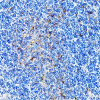 Anti-PSMD10 Antibody (CAB1949)