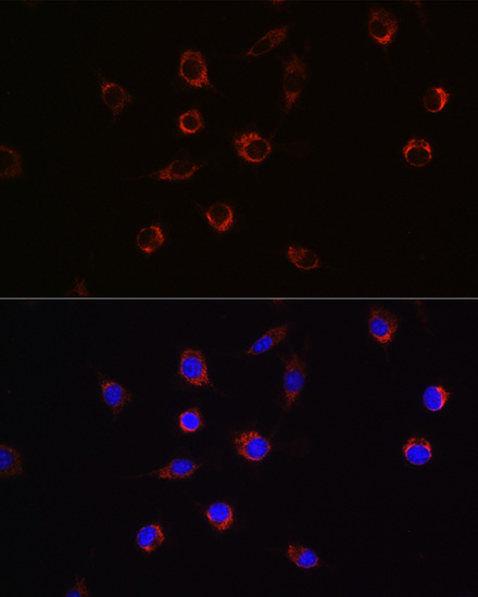 Anti-APLP2 Antibody (CAB5455)