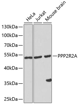 Anti-PPP2R2A Antibody (CAB13530)