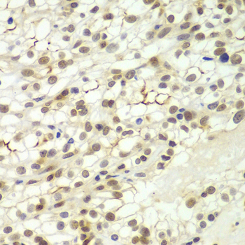 Anti-LHX4 Polyclonal Antibody (CAB8072)