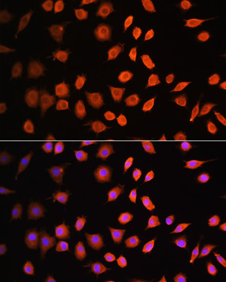 Anti-CDK6 Antibody (CAB16357)