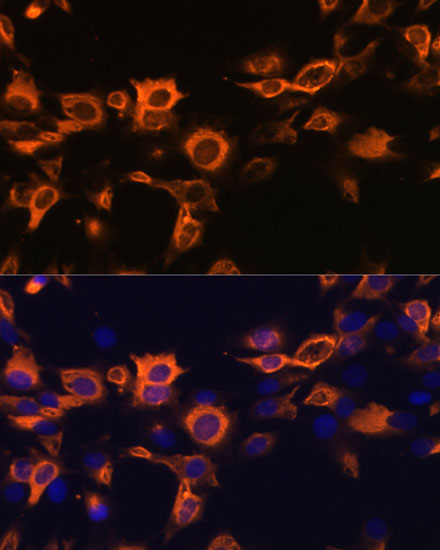 Anti-CSF2 Antibody (CAB6127)