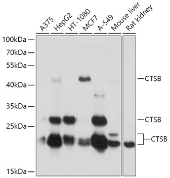 Anti-CTSB Antibody (CAB0967)