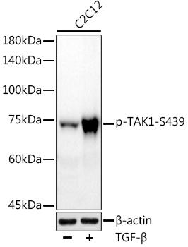 Western blot analysis of extracts of various cell lines, using at 1:1000 dilution. C2C12 cells were treated by TGF-ÃŽÂ² (10 ng/ml) at 37Ã¢â€žÆ’ for 30 minutes. Secondary antibody: HRP Goat Anti-Rabbit IgG (H+L) at 1:10000 dilution. Lysates/proteins: 25ug per lane. Blocking buffer: 3% nonfat dry milk in TBST. Detection: ECL Basic Kit. Exposure time: 90s.