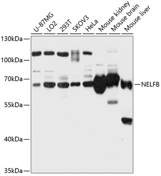 Anti-NELFB Antibody (CAB12023)