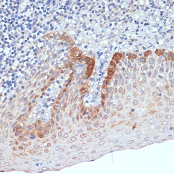 Anti-CXCL12 Antibody (CAB1325)