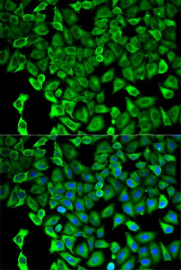 Anti-PSMD2 Antibody (CAB1999)