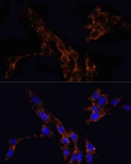 Anti-TGFB1 Antibody (CAB15103)