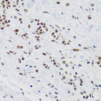 Anti-SUMO2 Antibody (CAB2486)