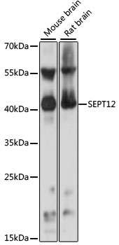 Anti-SEPT12 Antibody (CAB15564)