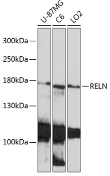 Anti-RELN Antibody (CAB17936)