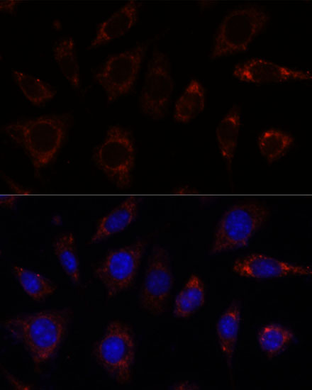 Anti-TBRG4 Antibody (CAB15753)