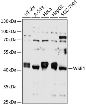 Anti-WSB1 Antibody (CAB12195)