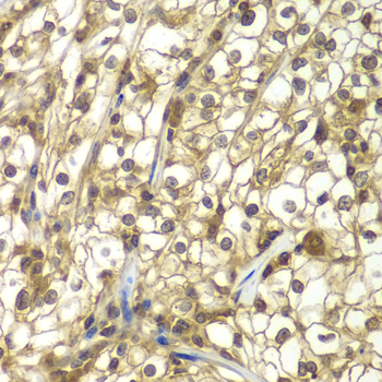 Anti-SULT2B1 Antibody (CAB7736)