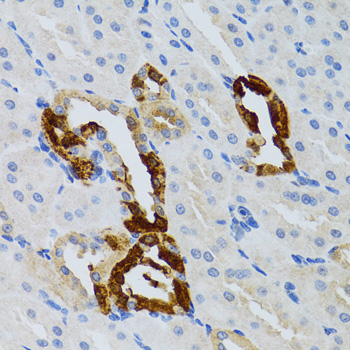 Anti-GRB2 Antibody (CAB5689)