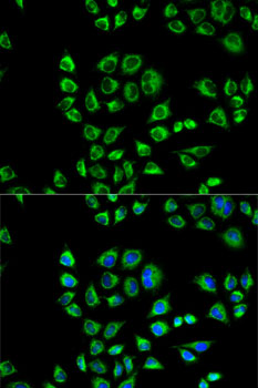 Anti-CD1D Antibody (CAB1760)