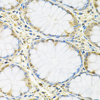 Anti-FMR1 Antibody (CAB5645)