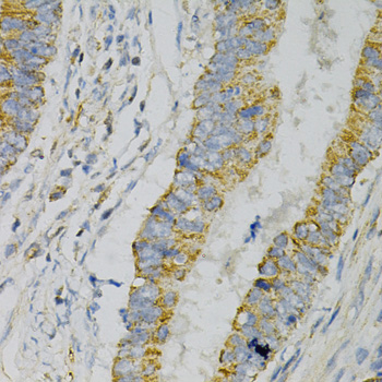 Anti-GNAO1 Antibody (CAB2510)