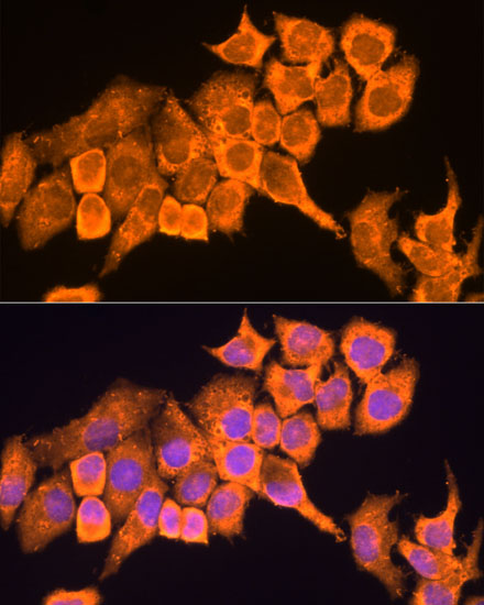 Anti-RPL23 Antibody (CAB4292)