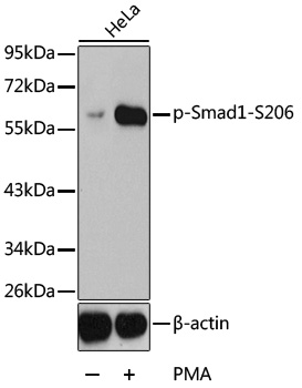 Anti-Phospho-SMAD1-S206 Antibody (CABP0295)