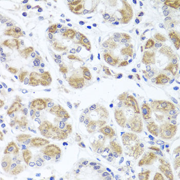 Anti-ACP1 Antibody (CAB1801)