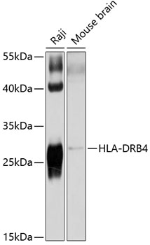 Anti-HLA-DRB4 Antibody (CAB10078)