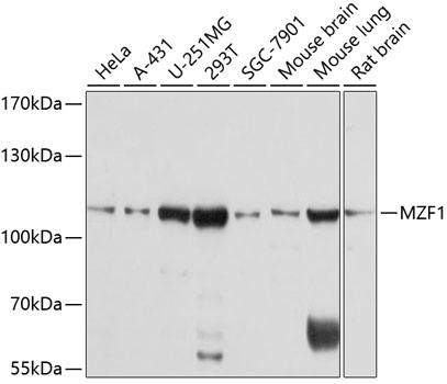 Anti-MZF1 Antibody (CAB10356)
