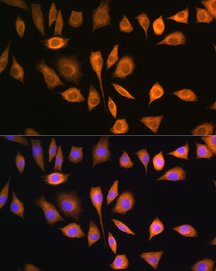 Anti-SOAT1 Antibody (CAB6311)