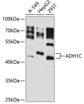 Anti-ADH1C Polyclonal Antibody (CAB8081)