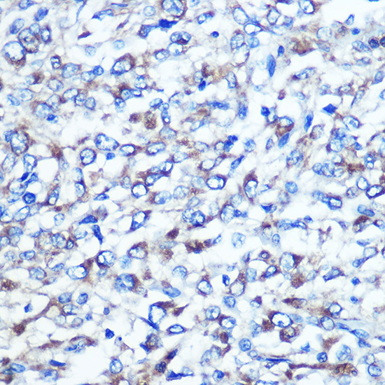 Anti-OPTN Antibody (CAB1845)