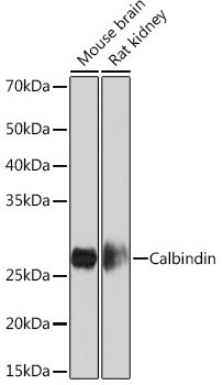 Anti-Calbindin Antibody (CAB4284)