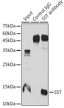 Anti-Somatostatin Polyclonal Antibody (CAB9274)