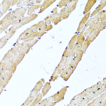 Anti-CALCB Polyclonal Antibody (CAB8105)