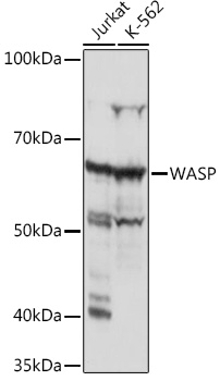 Anti-WASP Antibody (CAB5132)