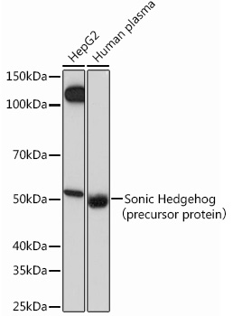 Anti-Sonic Hedgehog Antibody