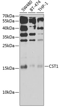 Anti-CST1 Antibody (CAB13290)