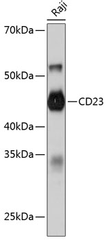 Anti-CD23 Antibody