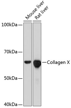 Anti-Collagen X Antibody