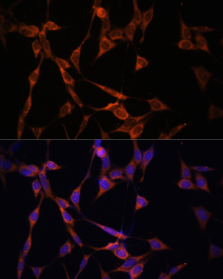 Anti-TGFBR1 Antibody (CAB16983)