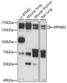 Anti-PPP6R3 Antibody (CAB17177)