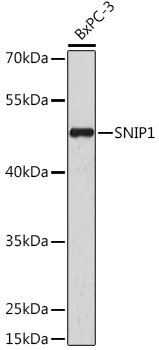 Anti-SNIP1 Antibody (CAB16747)