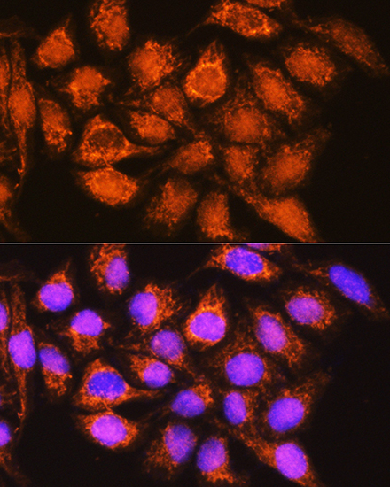 Anti-ALDH1B1 Antibody (CAB3725)