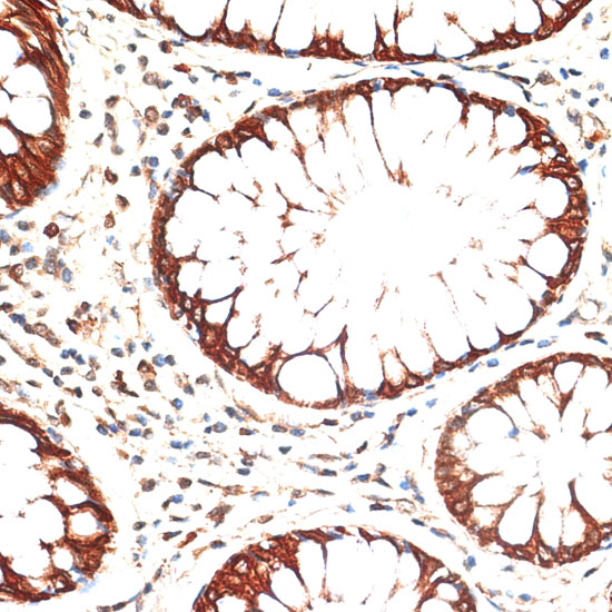 Anti-KRT13 Antibody (CAB16393)