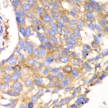 Anti-CAPNS1 Antibody (CAB6539)