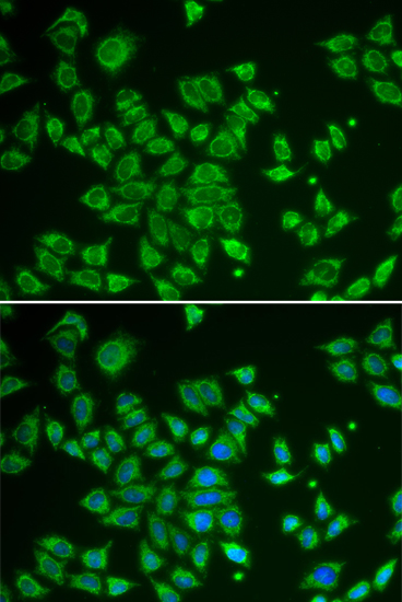 Anti-Smad1 Antibody (CAB1101)