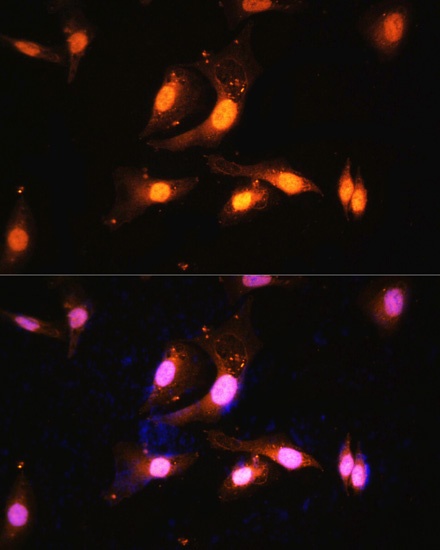 Anti-FLCN Antibody (CAB14521)