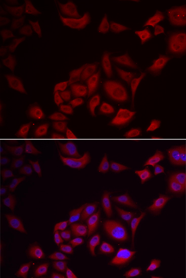 Anti-PIKFYVE Antibody (CAB6689)