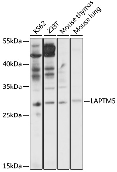 Anti-LAPTM5 Antibody (CAB17995)