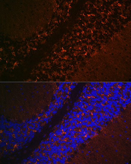 Anti-SLC17A6 Antibody (CAB15177)