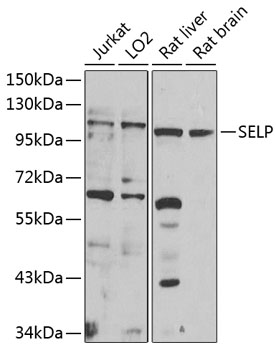 Anti-SELP Antibody (CAB1425)